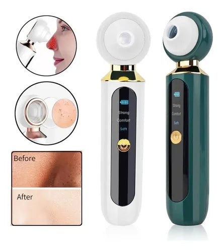 EXTRACTOR DE ESPINILLAS Y PUNTOS NEGROS + ENVIO GRATIS