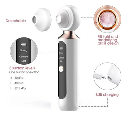 EXTRACTOR DE ESPINILLAS Y PUNTOS NEGROS + ENVIO GRATIS