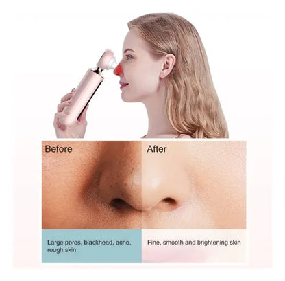 EXTRACTOR DE ESPINILLAS Y PUNTOS NEGROS + ENVIO GRATIS