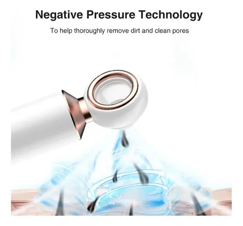 EXTRACTOR DE ESPINILLAS Y PUNTOS NEGROS + ENVIO GRATIS