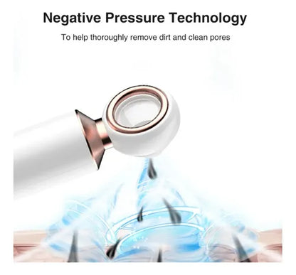 EXTRACTOR DE ESPINILLAS Y PUNTOS NEGROS + ENVIO GRATIS